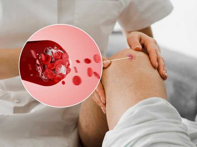 Анализ крови на ревматоидный фактор: как и для чего сдать?