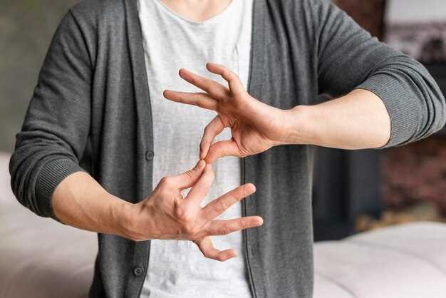 Сильный зуд на руках: причины и методы лечения [Аллергии Здоровье]