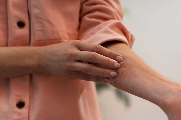 Сыпь на руках: причины, симптомы, лечение – полное руководство [Акне Здоровье]
