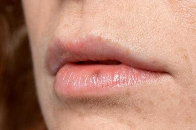 Причины сыпи на верхней губе