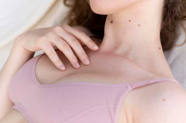 Сыпь в зоне декольте: причины, симптомы и способы лечения