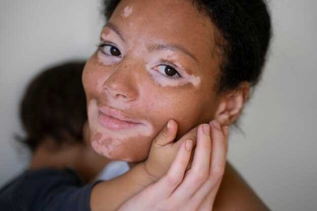 Эффективные методы лечения темных пятен на коже